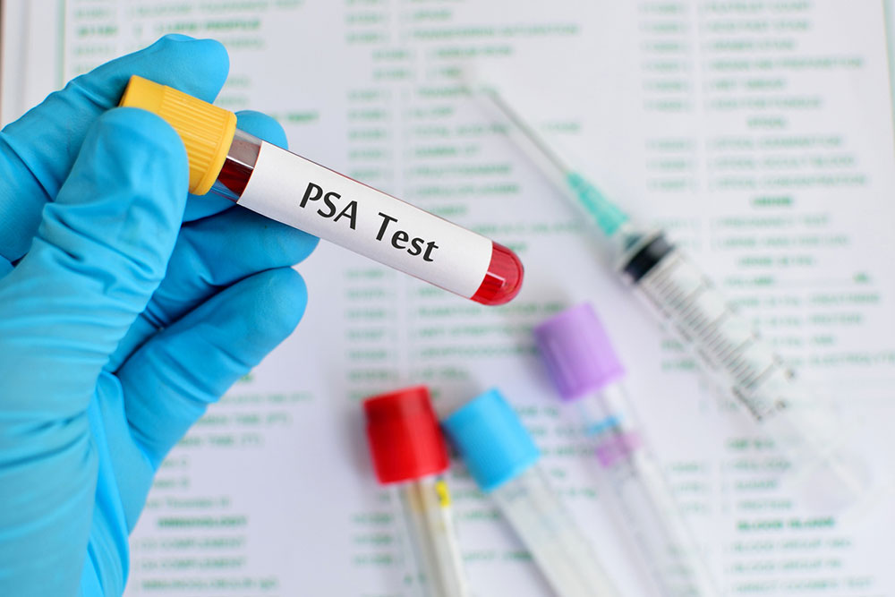 The importance of a PSA test